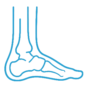Ankle Surgery - Gold Coast Surgeon