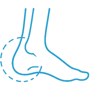 Hindfoot & Heel Conditions - Gold Coast Surgeon