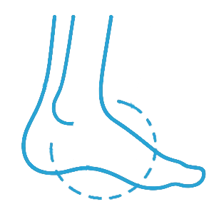Midfoot Conditions - Gold Coast Surgeon