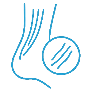 Tendon & Soft Tissue Conditions - Gold Coast Surgeon